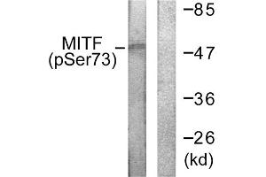 Western blot analysis of extracts from COS7 cells, using MITF (Phospho-Ser180/73) antibody. (MITF antibody  (pSer73, pSer180))