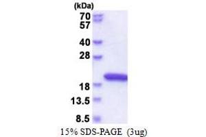 NudC Domain Containing 2 (NUDCD2) (AA 1-157) protein (His tag)