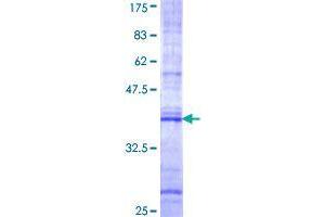 FNBP1 Protein (AA 70-163) (GST tag)