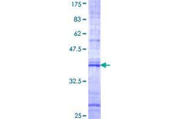 FNBP1 Protein (AA 70-163) (GST tag)