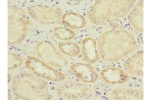 Immunohistochemistry of paraffin-embedded human kidney tissue using ABIN7156807 at dilution of 1:100 (IL17 Receptor B antibody  (AA 18-292))