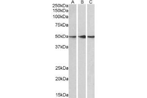 ABIN2564672 (0. (PPP2R5E antibody  (C-Term))