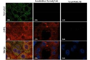 Immunohistochemistry of Rabbit anti-Sprouty2 antibody. (SPRY2 antibody  (Internal Region))