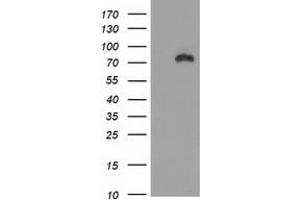 Image no. 2 for anti-Catenin (Cadherin-Associated Protein), beta 1, 88kDa (CTNNB1) antibody (ABIN1496891) (CTNNB1 antibody)