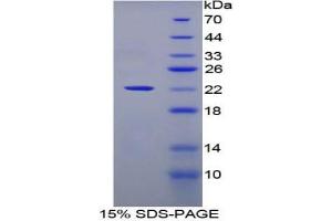 SDS-PAGE analysis of Human CLEC4M Protein.