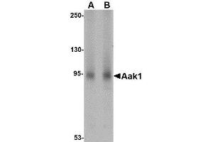 Western blot analysis of Aak1 in A-20 lysate with AP30003PU-N Aak1 antibody at (A) 1 and (B) 2 μg/ml. (AAK1 antibody  (N-Term))