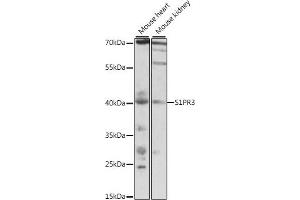 Western blot analysis of extracts of various cell lines, using S1PR3 antibody (ABIN7270535) at 1:1000 dilution. (S1PR3 antibody  (AA 100-200))