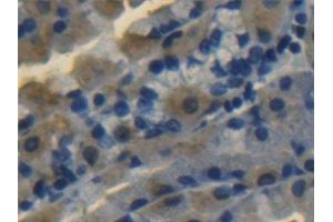 Detection of ALDH1A1 in Human Stomach Tissue using Polyclonal Antibody to Aldehyde Dehydrogenase 1 Family, Member A1 (ALDH1A1) (ALDH1A1 antibody  (AA 2-501))
