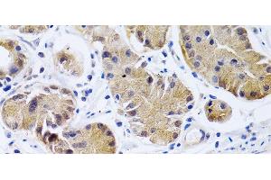 Immunohistochemistry of paraffin-embedded Human stomach using PTGIR Polyclonal Antibody at dilution of 1:200 (40x lens). (Prostacyclin Receptor antibody)