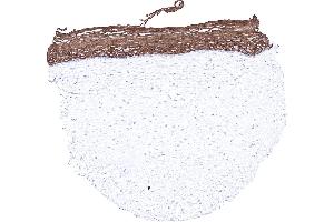 Uterus ectocervix (Recombinant Keratin 6 antibody)