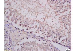 Formalin-fixed and paraffin embedded rat testis tissue labeled with Anti-COMMD4 Polyclonal Antibody, Unconjugated 1:400 followed by conjugation to the secondary antibody and DAB staining. (COMMD4 antibody  (AA 1-100))