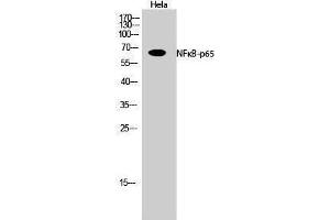 Western Blotting (WB) image for anti-Nuclear Factor-kB p65 (NFkBP65) (Thr72) antibody (ABIN3185888) (NF-kB p65 antibody  (Thr72))