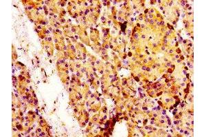 IHC image of ABIN7160041 diluted at 1:100 and staining in paraffin-embedded human pancreatic tissue performed on a Leica BondTM system. (MAP3K4 antibody  (AA 53-145))