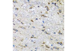 Immunohistochemistry of paraffin-embedded mouse spinal cord using BLZF1 antibody (ABIN2561429) at dilution of 1:100 (40x lens). (BLZF1 antibody)