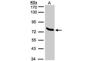 WB Image Sample(30 μg of whole cell lysate) A:293T 7. (ZNF45 antibody)