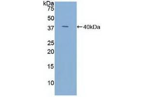 Detection of Recombinant TFF3, Human using Polyclonal Antibody to Trefoil Factor 3 (TFF3) (TFF3 antibody  (AA 22-80))