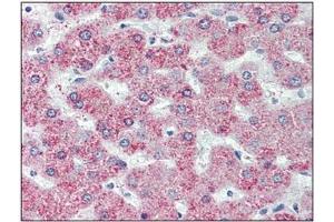 Immunohistochemistry: GPR146 antibody staining of Formalin-Fixed, Paraffin-Embedded Human Liver. (GPR146 antibody  (Internal Region))
