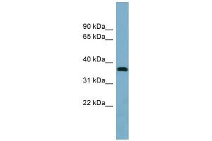 WB Suggested Anti-NEURL2 Antibody Titration: 0. (NEURL2 antibody  (Middle Region))