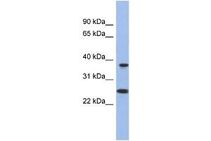 WB Suggested Anti-MTRF1L Antibody Titration: 0.