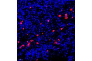 Immunofluorescence of paraffin embedded human lymph node using CSF1 (ABIN7073553) at dilution of 1:900 (400x lens) (M-CSF/CSF1 antibody)