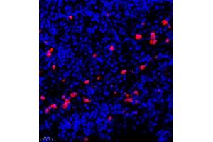 Immunofluorescence of paraffin embedded human lymph node using CSF1 (ABIN7073553) at dilution of 1:900 (400x lens)