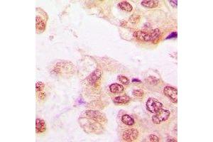 Immunohistochemistry (IHC) image for anti-Protein tyrosine Phosphatase, Non-Receptor Type 2 (PTPN2) antibody (ABIN7308244) (PTPN2 antibody)