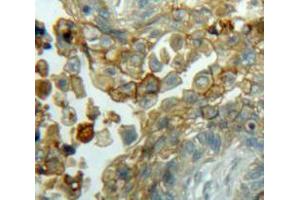 Used in DAB staining on fromalin fixed paraffin-embedded Lung tissue (Cyclin D3 antibody  (AA 1-292))