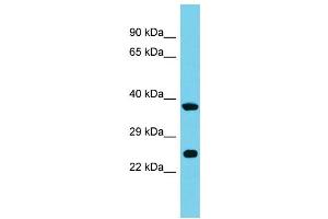 Host: Rabbit Target Name: MRPS26 Sample Type: 721_B Whole Cell lysates Antibody Dilution: 1. (MRPS26 antibody  (C-Term))