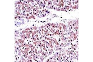 PTEN antibody immunohistochemistry analysis in formalin fixed and paraffin embedded human heart tissue. (PTEN antibody  (AA 264-295))