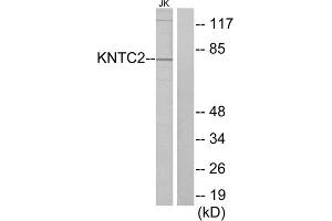 Western blot analysis of extracts from Jurkat cells, using KNTC2 antibody. (NDC80 antibody  (Internal Region))