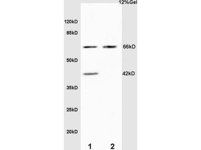anti-Elastin (ELN) (AA 681-786) antibody