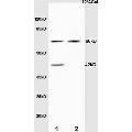 anti-Elastin (ELN) (AA 681-786) antibody