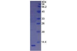 Image no. 1 for Vitronectin (VTN) (AA 400-468) protein (His tag) (ABIN1171646) (Vitronectin Protein (VTN) (AA 400-468) (His tag))