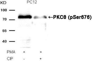 Western blot analysis of extracts from PC12 cells, treated with PMA or calf intestinal phosphatase (CIP), using PKCθ (Phospho-Ser676) Antibody. (PKC theta antibody  (pSer676))