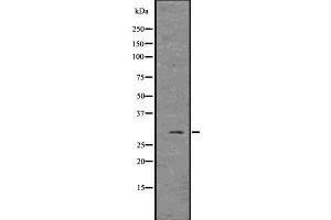 Western blot analysis of FGF3 using MCF7 whole  lysates. (FGF3 antibody)