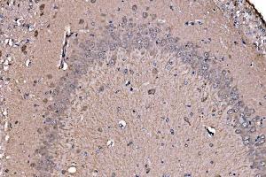 IHC analysis of ADRM1/ARM-1 using anti-ADRM1/ARM-1 antibody (ABIN7600108).