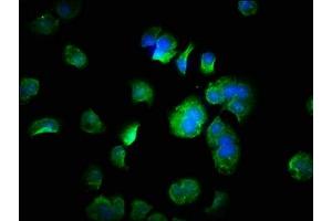 Immunofluorescence (IF) image for anti-Fibronectin Type III and Ankyrin Repeat Domains 1 (FANK1) (AA 1-345) antibody (ABIN7152879)