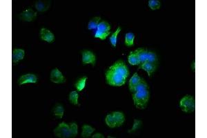 Immunofluorescence staining of MCF-7 cells with ABIN7152879 at 1:333, counter-stained with DAPI.