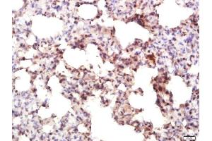 Paraformaldehyde-fixed, paraffin embedded rat lung tissue, Antigen retrieval by boiling in sodium citrate buffer(pH6) for 15min, Block endogenous peroxidase by 3% hydrogen peroxide for 30 minutes, Blocking buffer (normal goat serum) at 37°C for 20min, Antibody incubation with Rabbit Anti-IRF7 Polyclonal Antibody, Unconjugated  at 1:400 overnight at 4°C, followed by a conjugated secondary and DAB staining