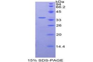 SDS-PAGE (SDS) image for Transferrin (TF) (AA 284-575) protein (His tag) (ABIN1879893) (Transferrin Protein (TF) (AA 284-575) (His tag))