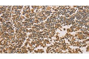 Immunohistochemistry of paraffin-embedded Human tonsil tissue using SETD2 Polyclonal Antibody at dilution 1:40 (SETD2 antibody)