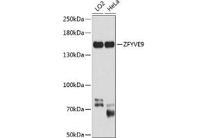 Western blot analysis of extracts of various cell lines, using ZFYVE9 antibody (ABIN6133286, ABIN6150442, ABIN6150443 and ABIN6224871) at 1:1000 dilution. (ZFYVE9 antibody  (AA 1-260))