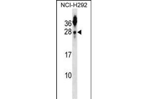 Tetraspanin 2 antibody  (N-Term)