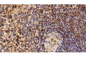 Immunohistochemistry (IHC) image for anti-Protein tyrosine Phosphatase, Receptor Type, C (PTPRC) (AA 357-547) antibody (ABIN7445726)