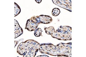 IHC analysis of TOP3B using anti-TOP3B antibody (ABIN7599907).