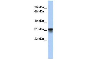 KDELR3 antibody used at 1 ug/ml to detect target protein. (KDELR3 antibody)
