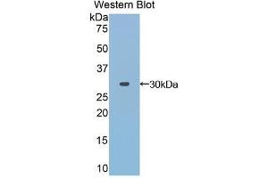 Western blot analysis of the recombinant protein. (TOLLIP antibody  (AA 28-261))