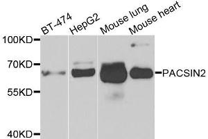Western blot analysis of extracts of various cell lines, using PACSIN2 antibody. (PACSIN2 antibody  (AA 240-410))