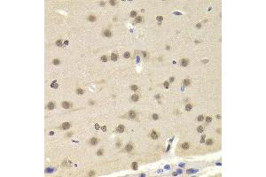 Immunohistochemistry of paraffin-embedded Mouse brain using ETV7 antibody at dilution of 1:100 (x400 lens). (ETV7 antibody)