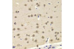 Immunohistochemistry of paraffin-embedded Mouse brain using ETV7 antibody at dilution of 1:100 (x400 lens).